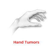 HandTumors