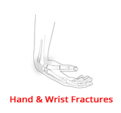 Handwristfractures