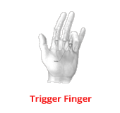 TriggerFingerIcon
